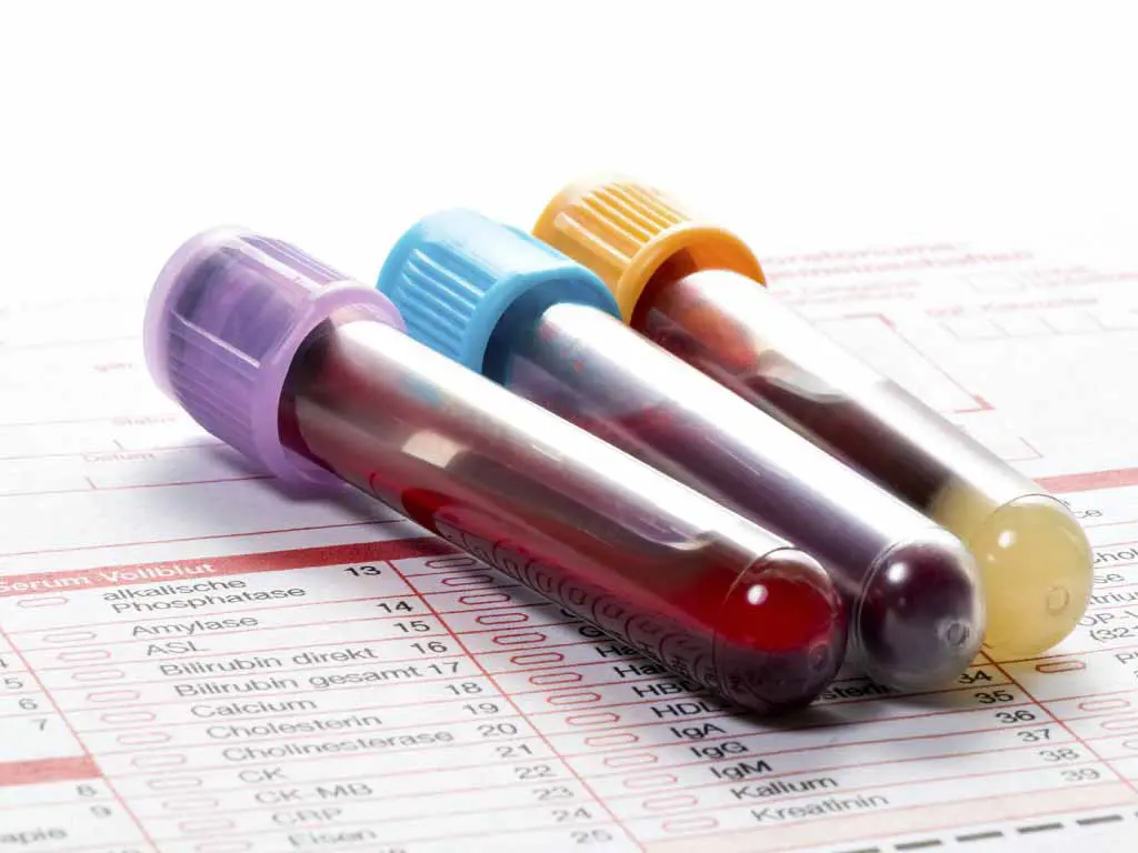 alcohol confirmatory test 1 2 Three blood vials on top of a form