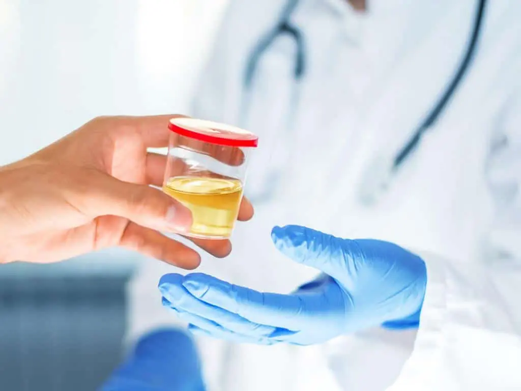 A person handing a urine sample to a medical professional