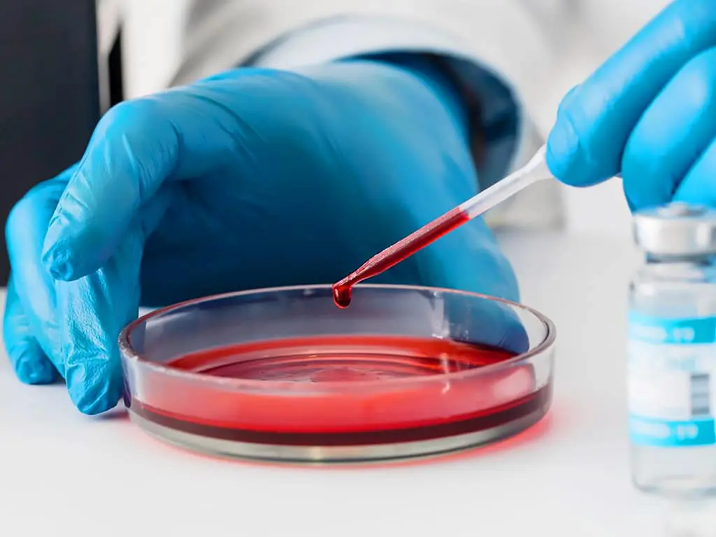 A lab officer testing a blood sample from a petri dish