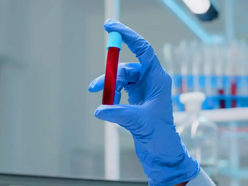 A close up of a hand holding a vial of blood sample
