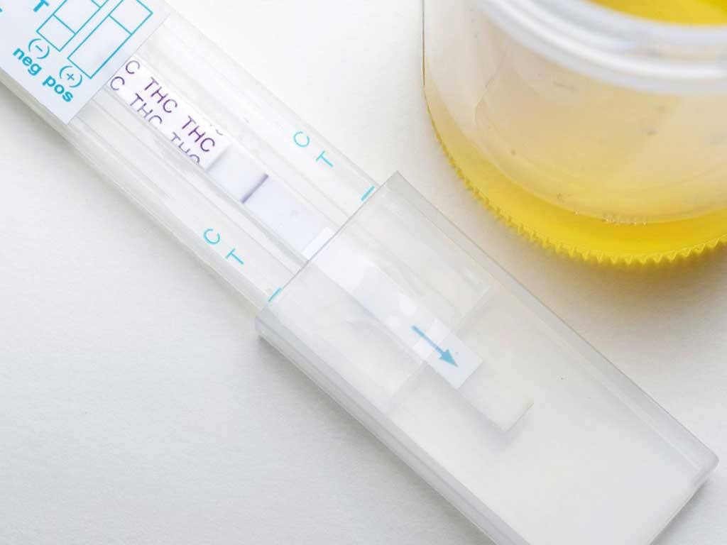 drug alcohol tests 1 A urine sample and THC test kit