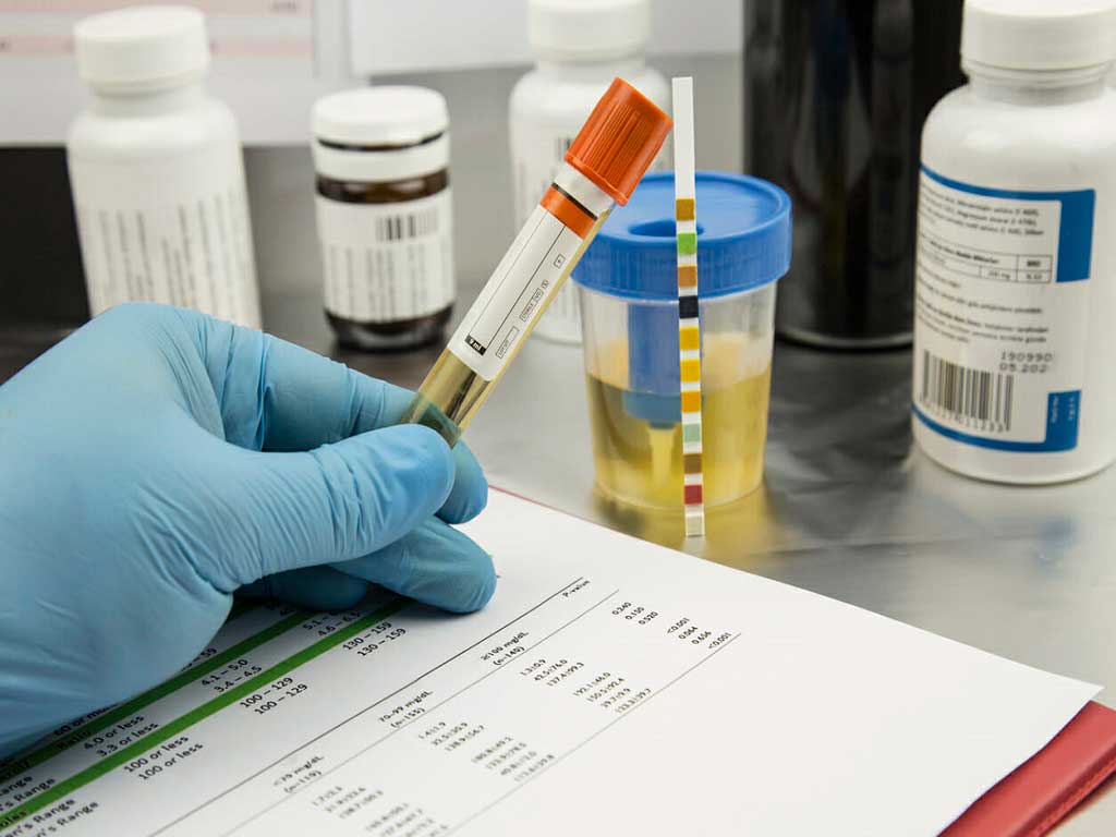 drug and alcohol screening perth 1 A lab technician holding a vial