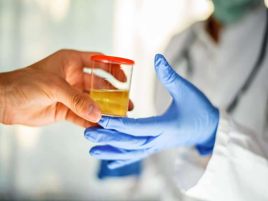 alcohol metabolite urine test 1 A person giving a urine sample to a lab professional