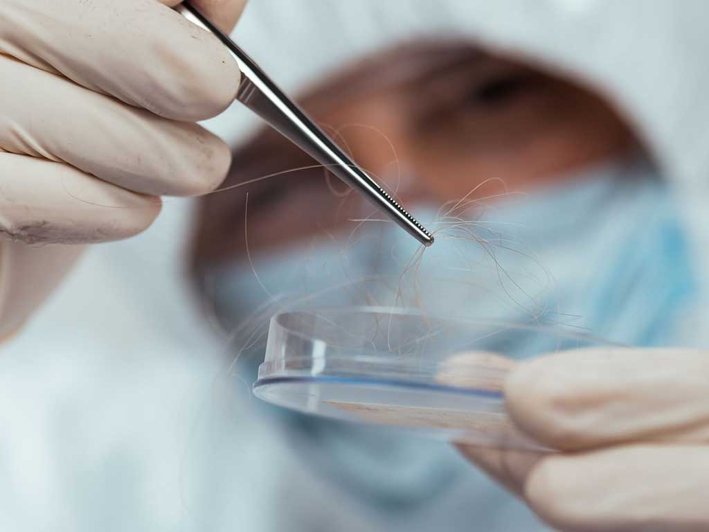 A professional placing a hair sample in a container