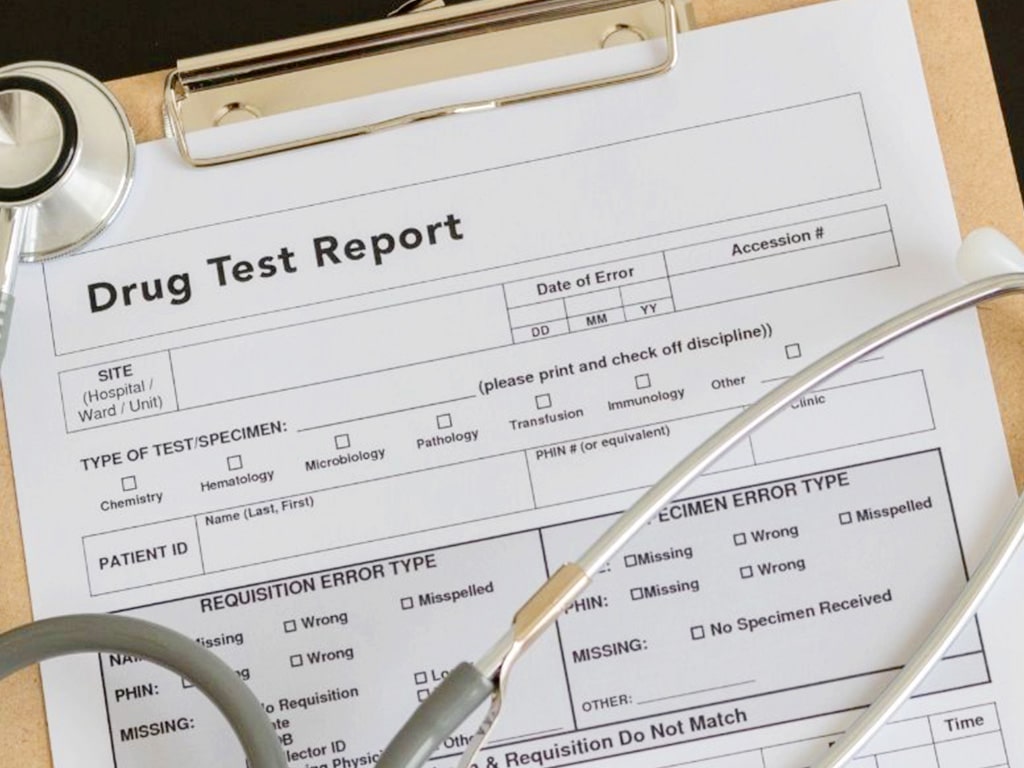 A drug test report form and a stethoscope