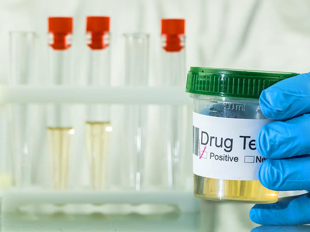 A lab professional holding a urine sample cup