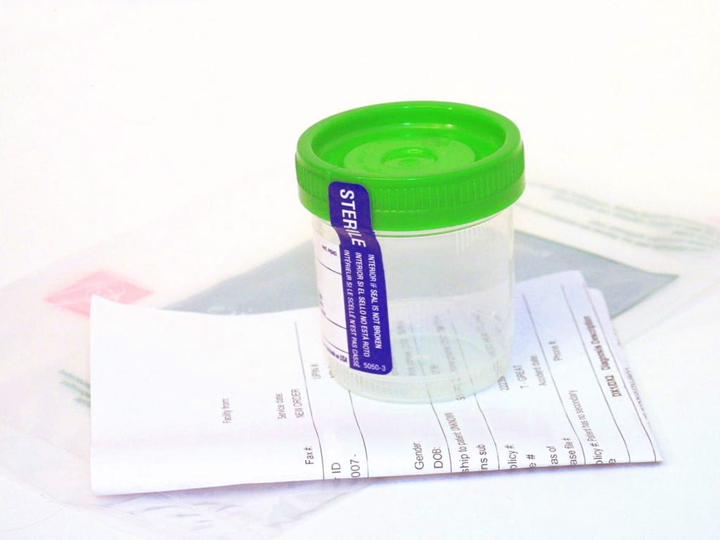 An empty urine sample container on a document