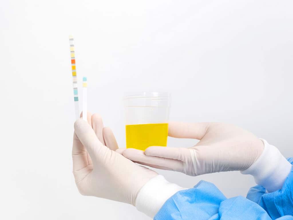 A certified collector holding a urine sample and a dip stick