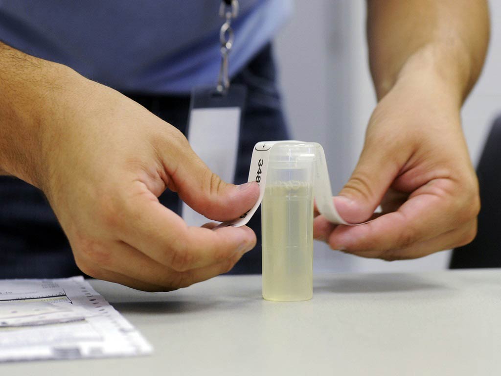 A staff sealing a urine sample container
