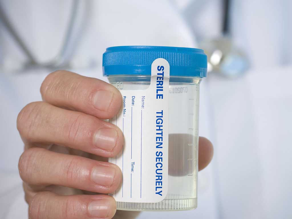 A professional holding a sterile urine container