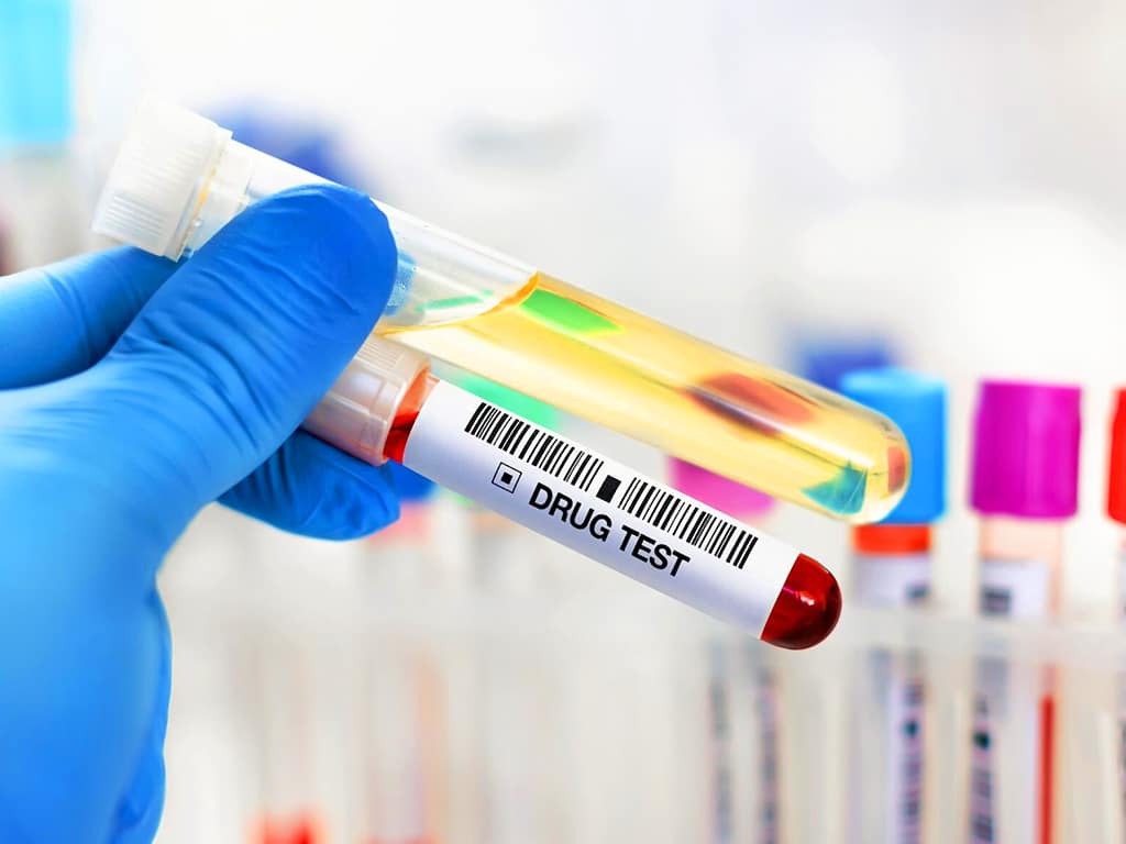 A lab professional holding two test tubes containing urine and blood samples