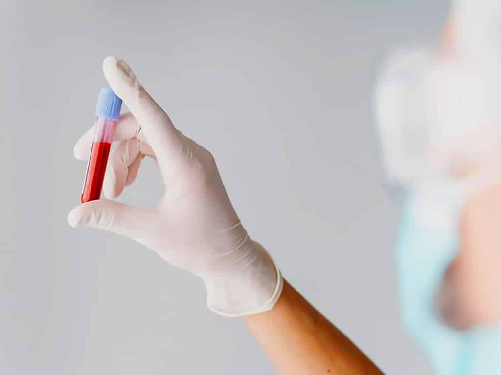 A lab professional looking at the blood sample vial in their hand