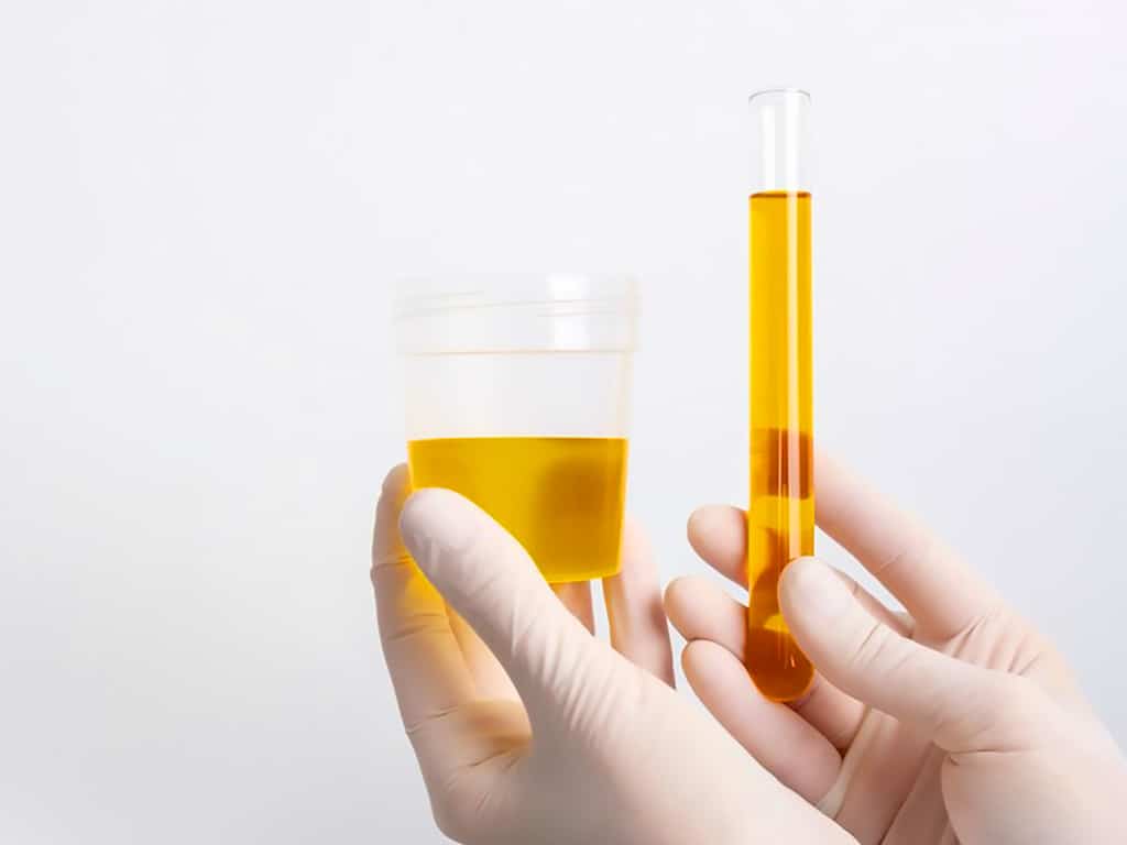 drug and alcohol screening tests 1 A gloved hand holding a container and vial containing urine samples