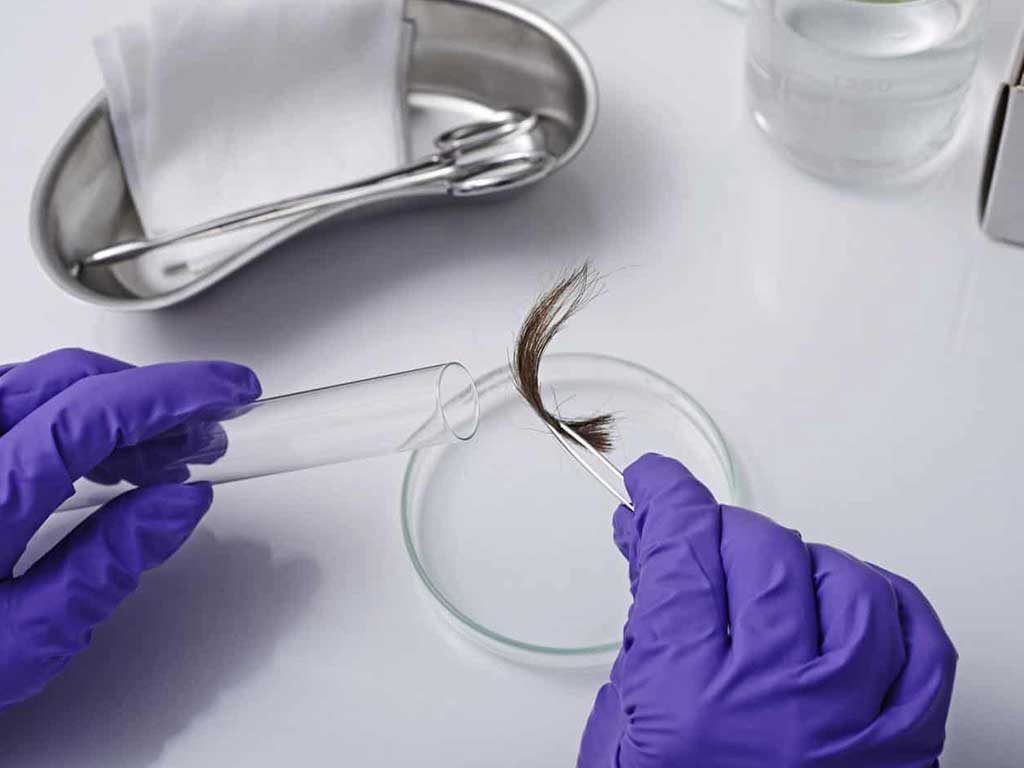 hair sample test 1 1 2 A gloved hand storing the hair samples in a vial