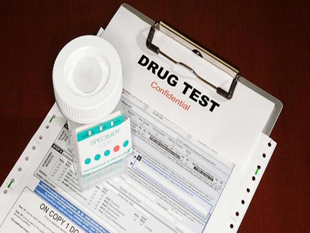 home drug test in australia 1 A testing kit on top of a drug test form