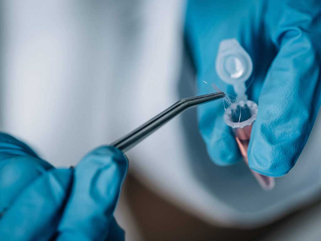 A medical professional inserting hair specimens into a small container