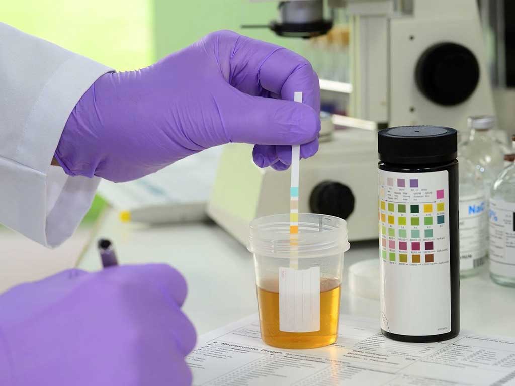 supervised drug testing near me 2 A lab technician conducting a urine analysis