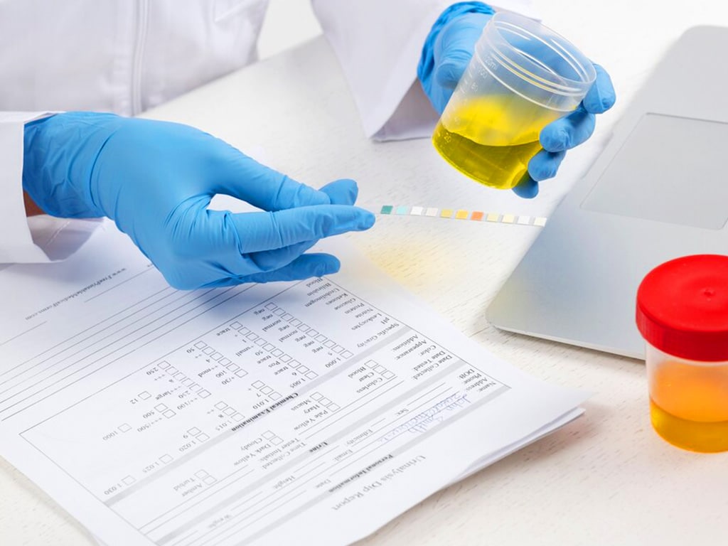 A professional comparing the urine sample to a colour chart