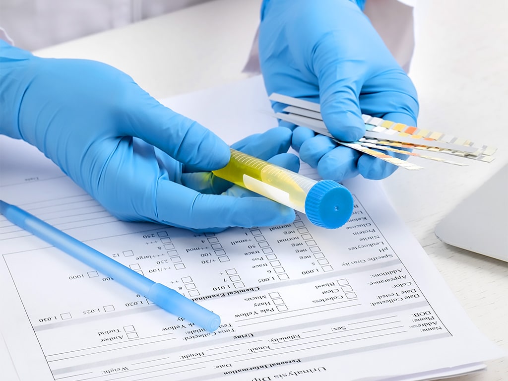 A testing officer holding a sample of urine and test strips while filling out a form